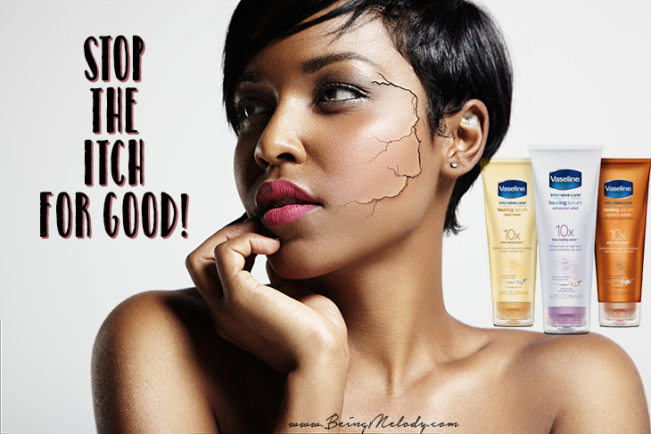 Heal Dry Itchy Skin with New Vaseline Intensive Care Healing Serum.